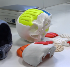 bone-forming implants